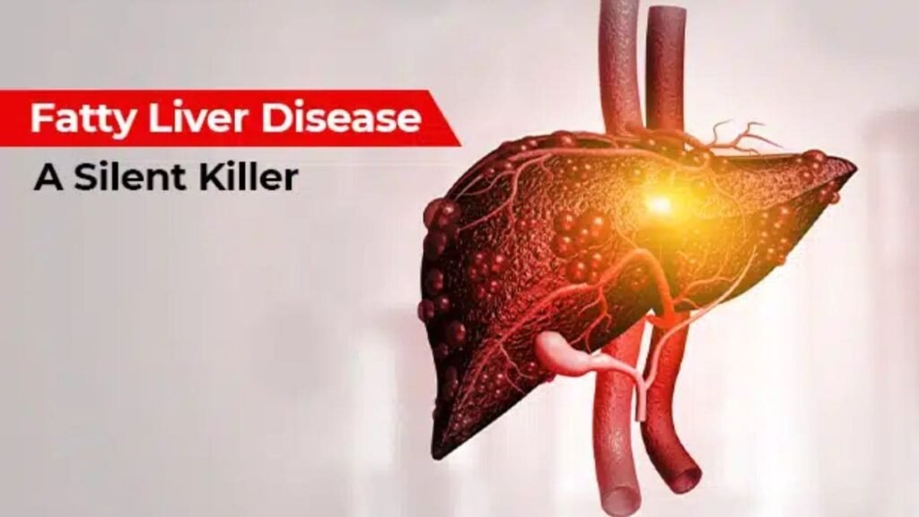 Doctor explains: How lifestyle choices and genetics are driving the alarming rise in fatty liver disease